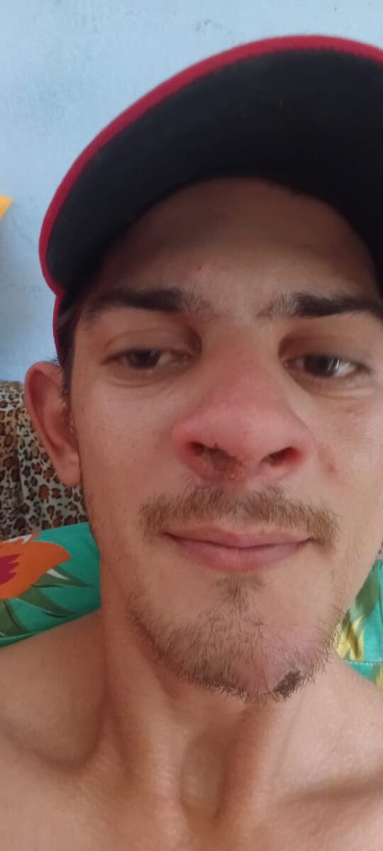 Família realiza rifa para custear tratamento de jovem com leishmaniose