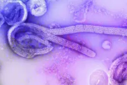 Homem é internado com suspeita de ebola em São Paulo