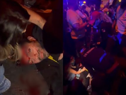 Organização de evento no RJ nega superlotação após jovem ser agredido até desmaiar Organização de evento no RJ nega superlotação após jovem ser agredido até desmaiar