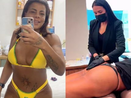 Tati Quebra Barraco faz harmonização no bumbum e brinca: “Prefiro a faca!” Tati Quebra Barraco faz harmonização no bumbum e brinca: “Prefiro a faca!”