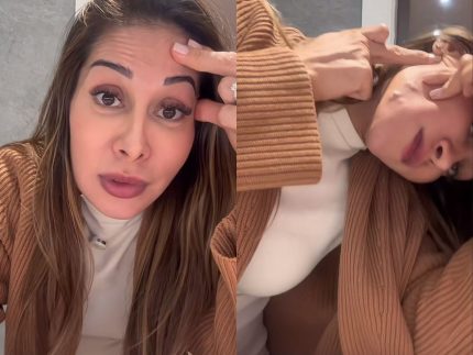 Maíra Cardi choca ao exibir danos de PMMA no rosto: “Tentando rasgar minha pele” Maíra Cardi choca ao exibir danos de PMMA no rosto: “Tentando rasgar minha pele”