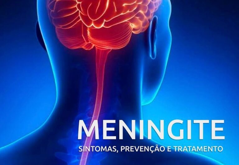 Cruzeiro do Sul concentra mais da metade dos casos de meningite no Acre Município do interior lidera casos de meningite no Acre em 2026