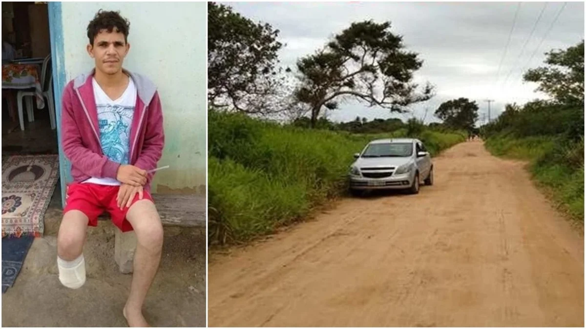 Justiça condena servidor que amputou o pé para fraudar R$ 1,5 milhão Justiça condena servidor que amputou o pé para fraudar R$ 1,5 milhão