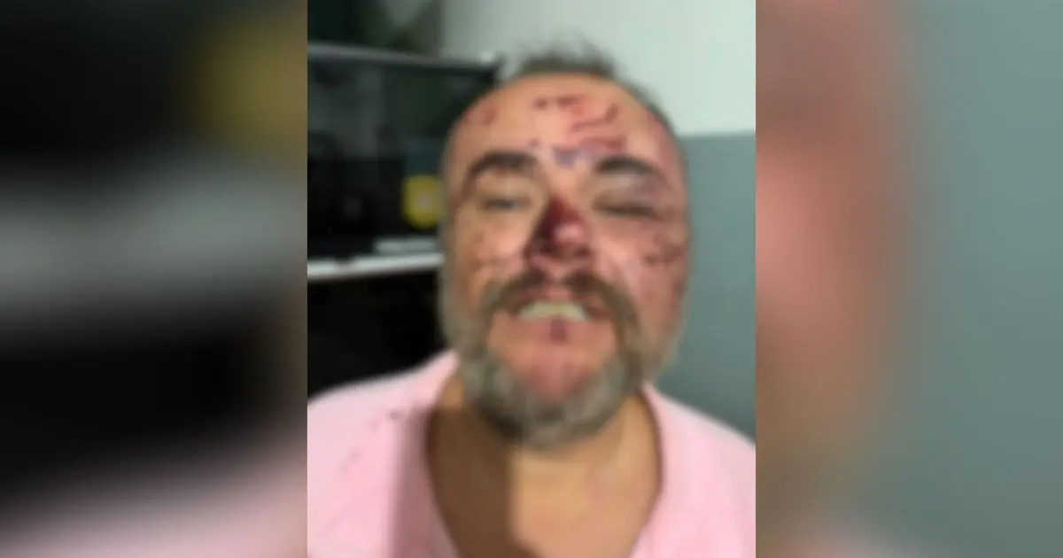 Veja imagens das supostas agressões de PMs a advogado no interior de SP Veja imagens das supostas agressões de PMs a advogado no interior de SP