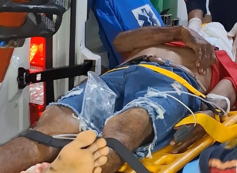 Ciclista fica ferido após ser atropelado por caminhonete em Rio Branco