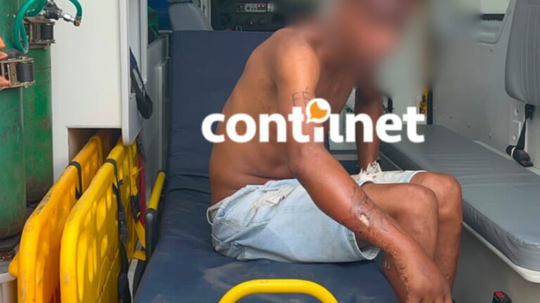 Homem em situação de rua é espancado e fica ferido após ataque Homem em situação de rua é espancado e fica ferido após ataque