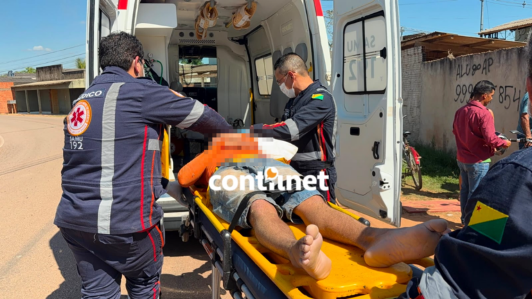 Motociclista perde controle, bate em muro e fica desacordado em Rio Branco