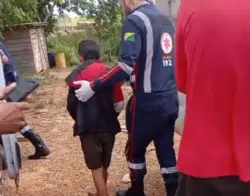 Criança é socorrida após ser atacada por cobra em zona rural no Acre