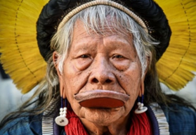 Cacique Raoni deixa a UTI e apresenta boa evolução clínica Cacique Raoni deixa a UTI e apresenta boa evolução clínica