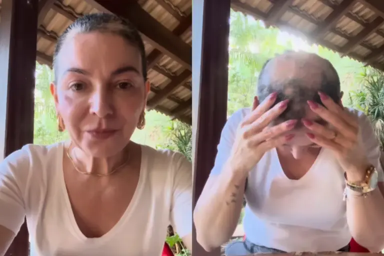Mãe de Lucas Lucco desabafa após retorno de queda de cabelo