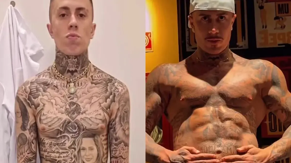 MC Daniel choca a web com antes e depois de procedimentos: “Milagres acontecem”