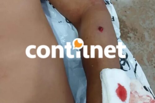 Monitorado pela Justiça fica ferido após disparo de espingarda no Acre