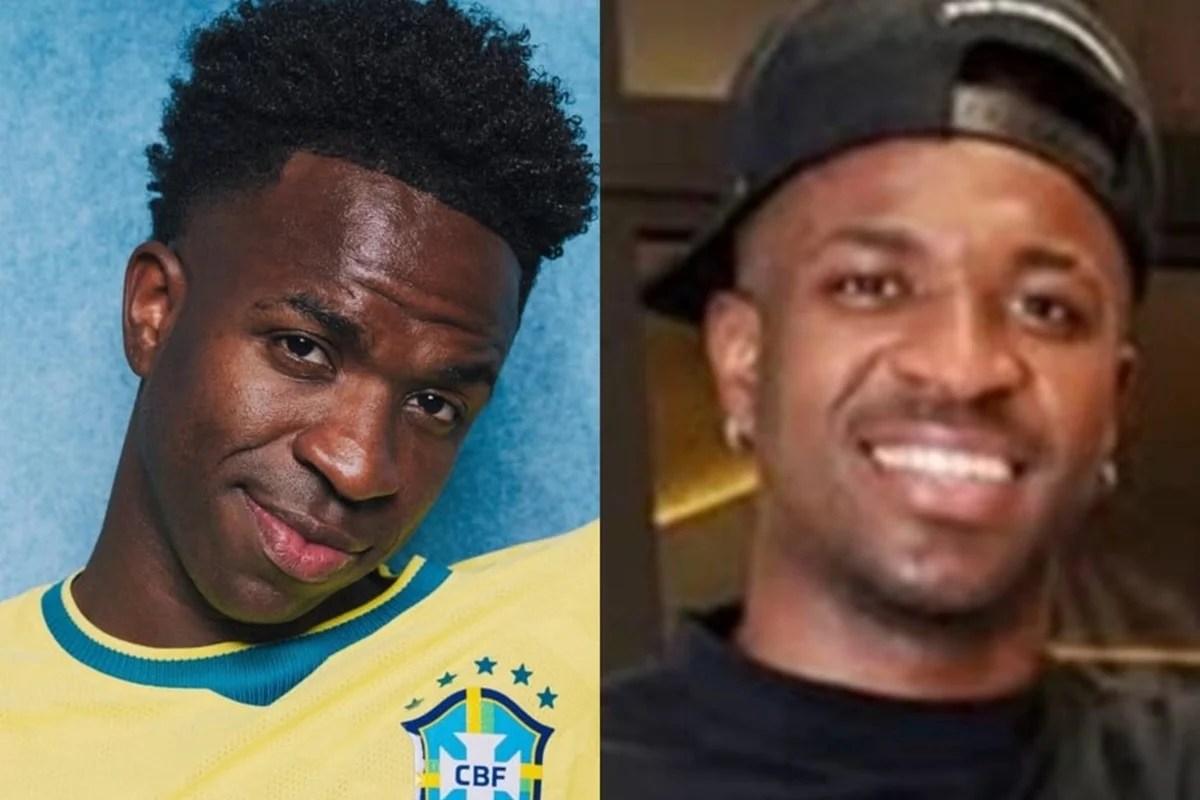 Vini Jr.: harmonização melhora rosto, mas não a respiração