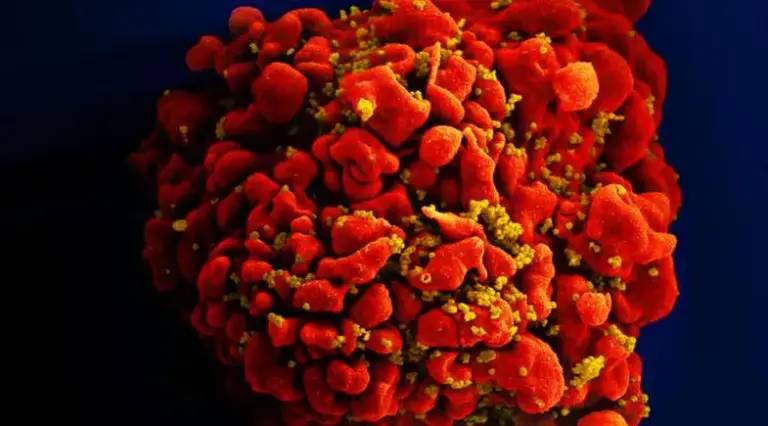 Célula infectada por partículas do vírus HIV