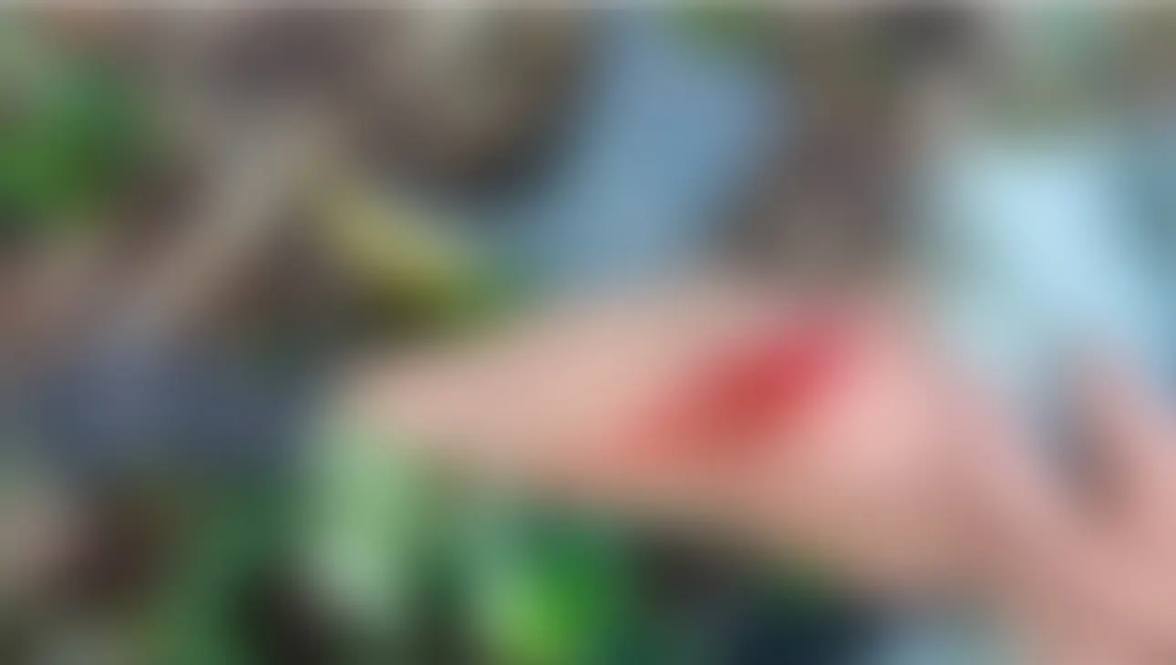 Morador fica ferido após acidente com terçado em comunidade rural no Acre