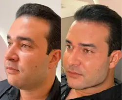 Juh Vellegas após harmonização do marido: ‘Um gato de verdade’; VÍDEO