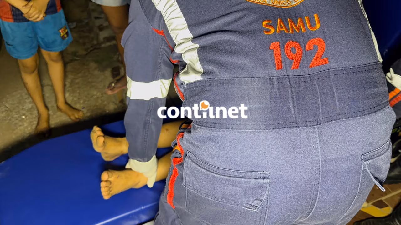 Criança é atropelada e motociclista tem dedo amputado durante acidente em Rio Branco