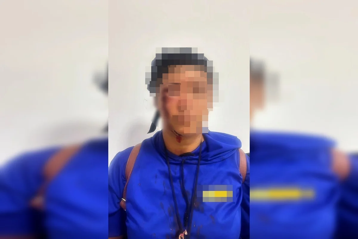 “Vou colocar pimenta”: agressora chicoteia mulher no Entorno do DF